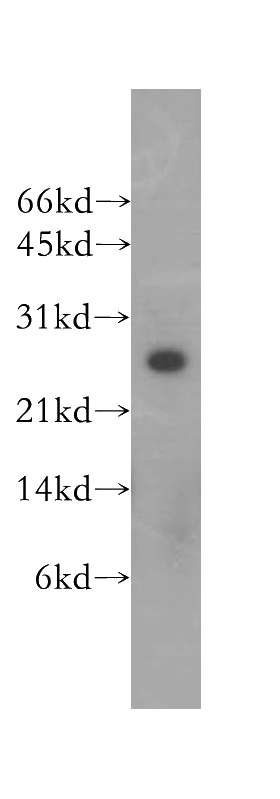 human brain tissue were subjected to SDS PAGE followed by western blot with Catalog No:111395(HEBP2 antibody) at dilution of 1:500
