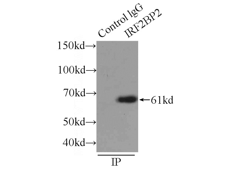 IP Result of anti-IRF2BP2 (IP:Catalog No:111834, 3ug; Detection:Catalog No:111834 1:500) with K-562 cells lysate 2400ug.