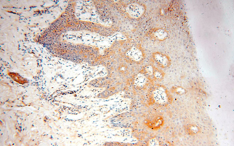 Immunohistochemical of paraffin-embedded human skin using Catalog No:116702(VAC14 antibody) at dilution of 1:100 (under 10x lens)