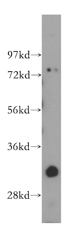 HepG2 cells were subjected to SDS PAGE followed by western blot with Catalog No:110941(GEMIN8 antibody) at dilution of 1:400