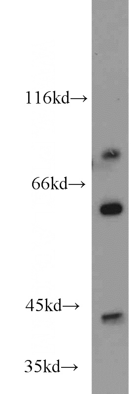 mouse skeletal muscle tissue were subjected to SDS PAGE followed by western blot with Catalog No:113821(PHKG1 antibody) at dilution of 1:800