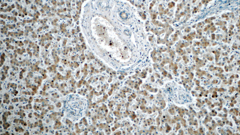 Immunohistochemistry of paraffin-embedded human liver tissue slide using Catalog No:111143(GPS2 Antibody) at dilution of 1:50 (under 10x lens)