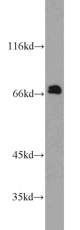 human placenta tissue were subjected to SDS PAGE followed by western blot with Catalog No:108836(CAPN6 antibody) at dilution of 1:300