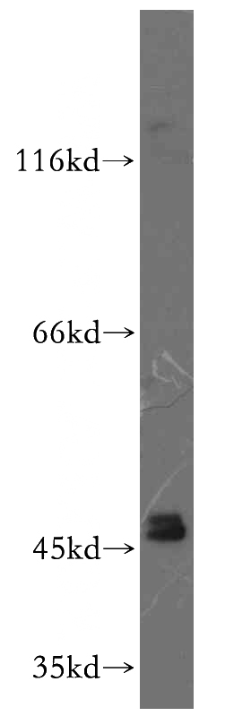 mouse liver tissue were subjected to SDS PAGE followed by western blot with Catalog No:110882(GATA4-Specific antibody) at dilution of 1:500