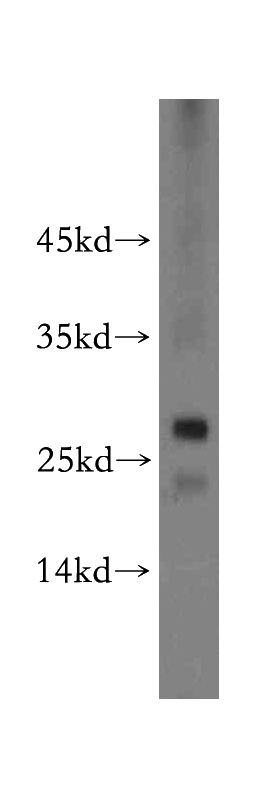Jurkat cells were subjected to SDS PAGE followed by western blot with Catalog No:117149(BIN3 antibody) at dilution of 1:500