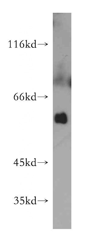 mouse skeletal muscle tissue were subjected to SDS PAGE followed by western blot with Catalog No:108787(C7orf10 antibody) at dilution of 1:500