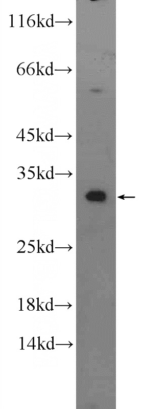 mouse lung tissue were subjected to SDS PAGE followed by western blot with Catalog No:109845(DECR2 Antibody) at dilution of 1:1000