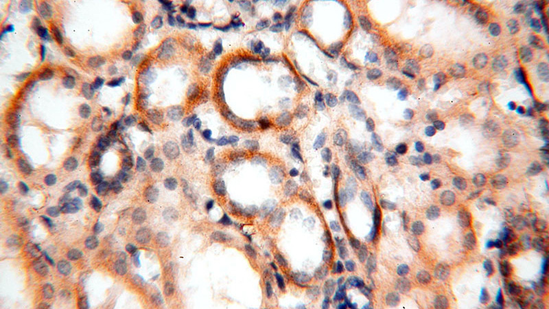 Immunohistochemical of paraffin-embedded human kidney using Catalog No:112840(MRPS11 antibody) at dilution of 1:100 (under 40x lens)