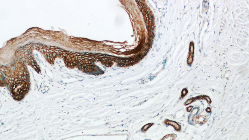 Immunohistochemical of paraffin-embedded human skin using Catalog No:114958(S100A14 antibody) at dilution of 1:50 (under 10x lens)