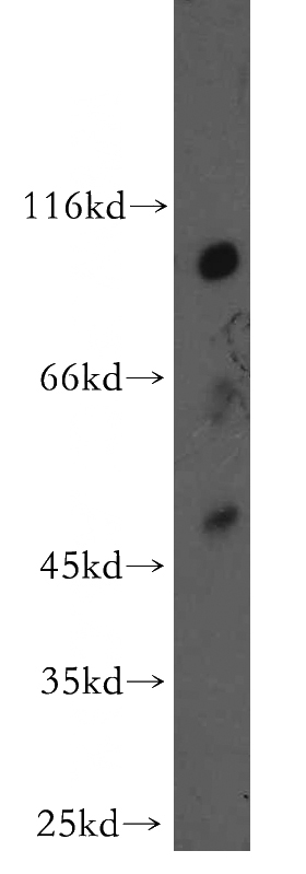 human brain tissue were subjected to SDS PAGE followed by western blot with Catalog No:113434(OSBPL9 antibody) at dilution of 1:300