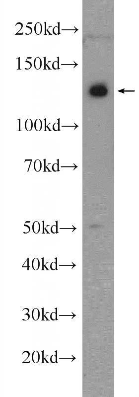 mouse brain tissue were subjected to SDS PAGE followed by western blot with Catalog No:113807(PHF12 Antibody) at dilution of 1:1000