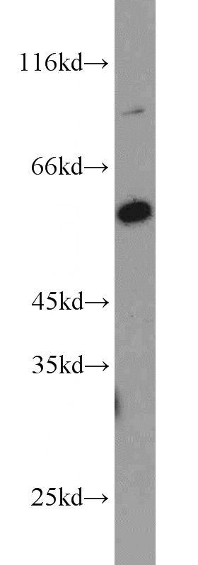 HeLa cells were subjected to SDS PAGE followed by western blot with Catalog No:113809(PHF17 antibody) at dilution of 1:500