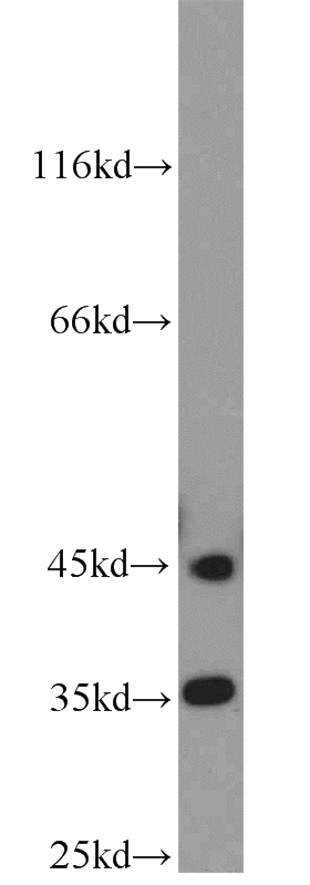 mouse brain tissue were subjected to SDS PAGE followed by western blot with Catalog No:113866(PHYHIP antibody) at dilution of 1:1000