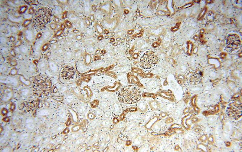 Immunohistochemical of paraffin-embedded human kidney using Catalog No:109646(CXCR7 antibody) at dilution of 1:50 (under 10x lens)