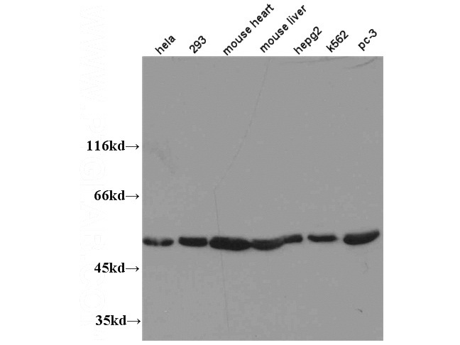 WB results of Catalog No:108350 (anti-ATP5A1 antibody).
