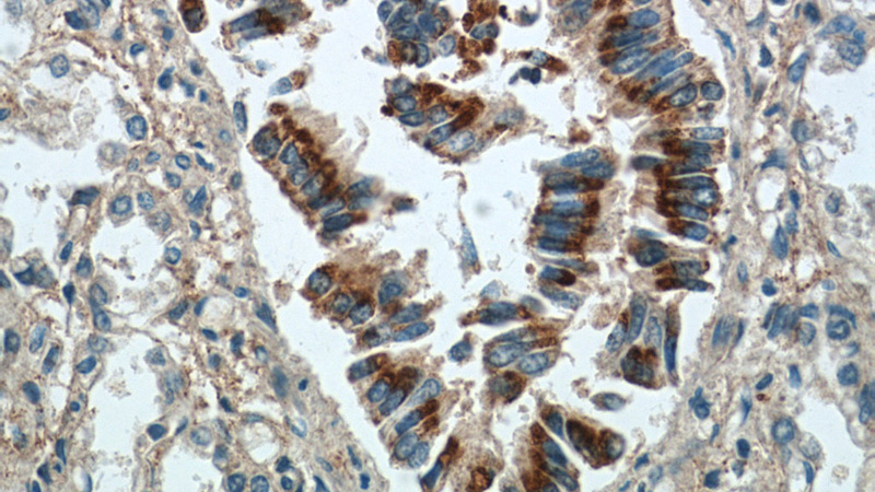 Immunohistochemistry of paraffin-embedded human lung tissue slide using Catalog No:111392(HEATR2 Antibody) at dilution of 1:50 (under 40x lens)