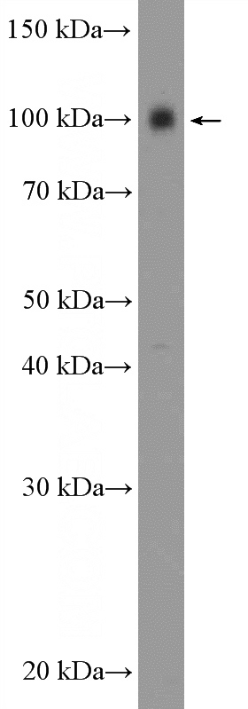 mouse brain membrane tissue were subjected to SDS PAGE followed by western blot with Catalog No:111927(KCNC4 Antibody) at dilution of 1:300