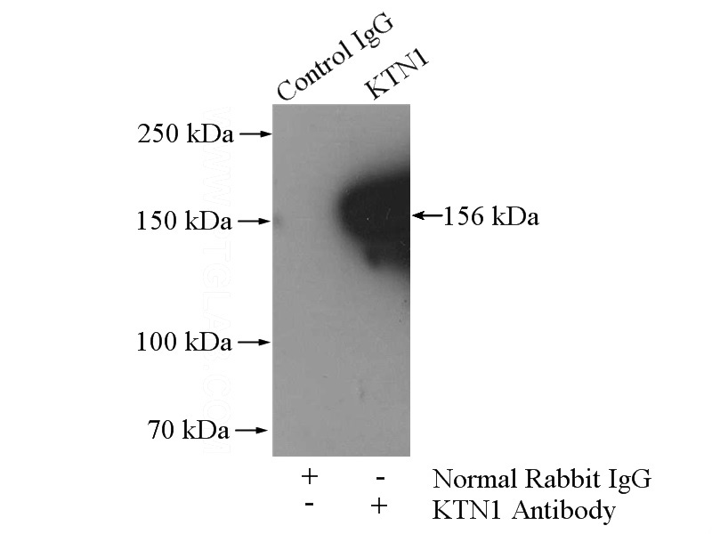 IP Result of anti-KTN1 (IP:Catalog No:112253, 4ug; Detection:Catalog No:112253 1:500) with Jurkat cells lysate 1200ug.