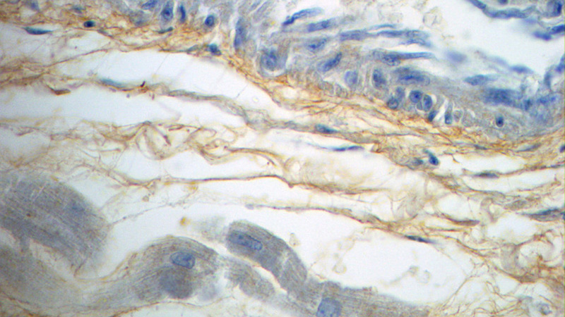 Immunohistochemistry of paraffin-embedded human heart slide using Catalog No:109379(COL4A1 Antibody) at dilution of 1:50 (under 40x lens)