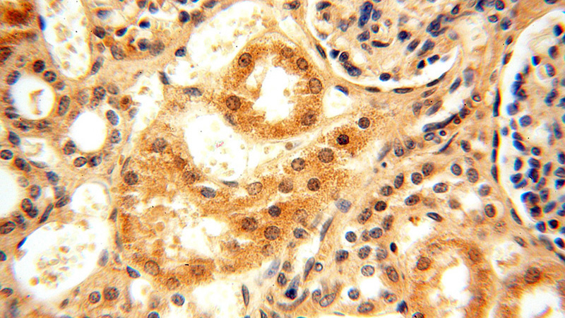 Immunohistochemical of paraffin-embedded human kidney using Catalog No:109463(COPS3 antibody) at dilution of 1:100 (under 40x lens)