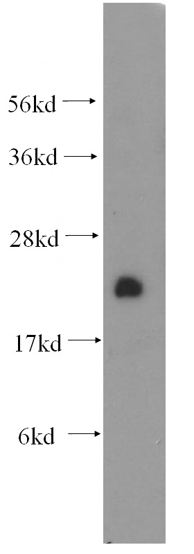mouse brain tissue were subjected to SDS PAGE followed by western blot with Catalog No:109561(Crip2 antibody) at dilution of 1:300