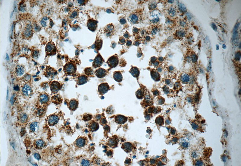 Immunohistochemistry of paraffin-embedded human testis tissue slide using Catalog No:115555(SPATA7 Antibody) at dilution of 1:50 (under 40x lens)
