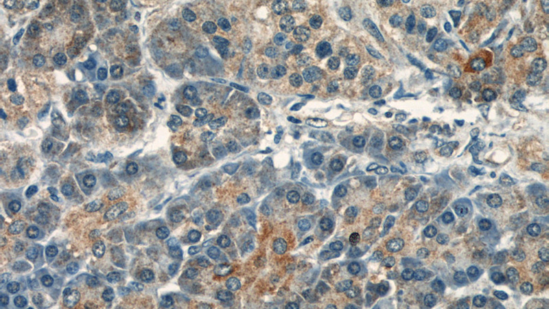 Immunohistochemical of paraffin-embedded human pancreas using Catalog No:116722(VAV2 antibody) at dilution of 1:50 (under 40x lens)