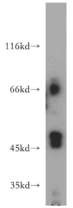 HeLa cells were subjected to SDS PAGE followed by western blot with Catalog No:109453(GJA1 antibody) at dilution of 1:500