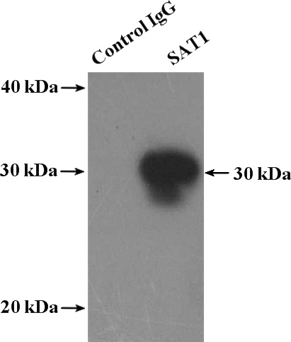 IP Result of anti-SAT1 (IP:Catalog No:114975, 4ug; Detection:Catalog No:114975 1:300) with mouse liver tissue lysate 4000ug.