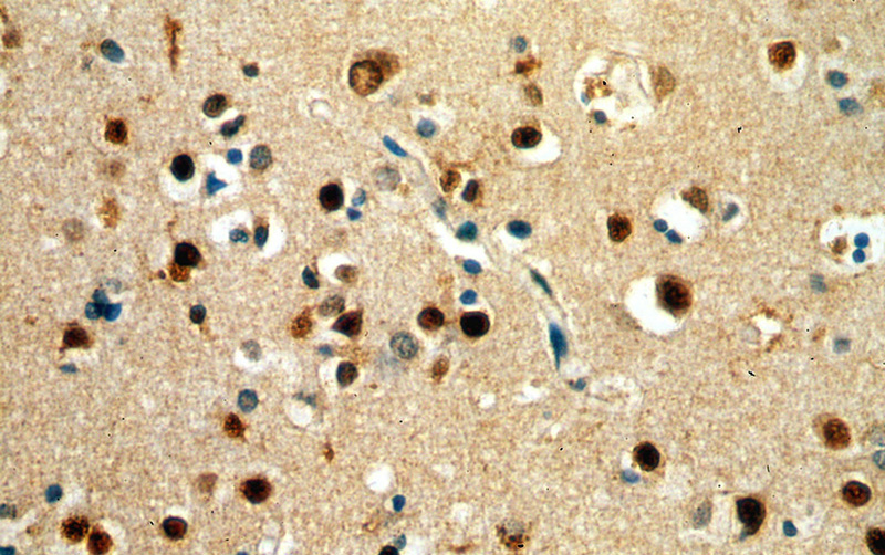Immunohistochemical of paraffin-embedded human brain using Catalog No:117242(POU3F2-Specific antibody) at dilution of 1:100 (under 40x lens)