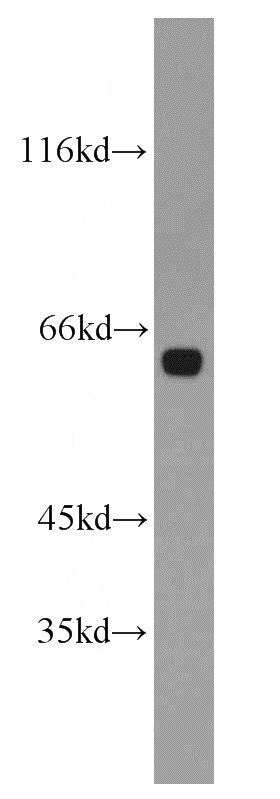 human brain tissue were subjected to SDS PAGE followed by western blot with Catalog No:111271(HBP1 antibody) at dilution of 1:1000
