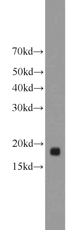 BxPC-3 cells were subjected to SDS PAGE followed by western blot with Catalog No:112833(MRPL49 antibody) at dilution of 1:800