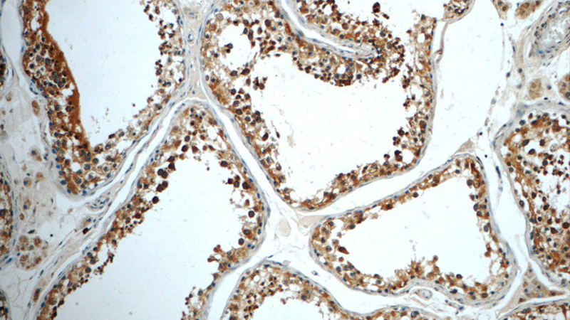 Immunohistochemistry of paraffin-embedded human testis tissue slide using Catalog No:110603(FAM8A1 Antibody) at dilution of 1:50 (under 10x lens)