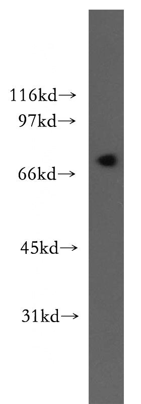 mouse testis tissue were subjected to SDS PAGE followed by western blot with Catalog No:112290(LNX1 antibody) at dilution of 1:70