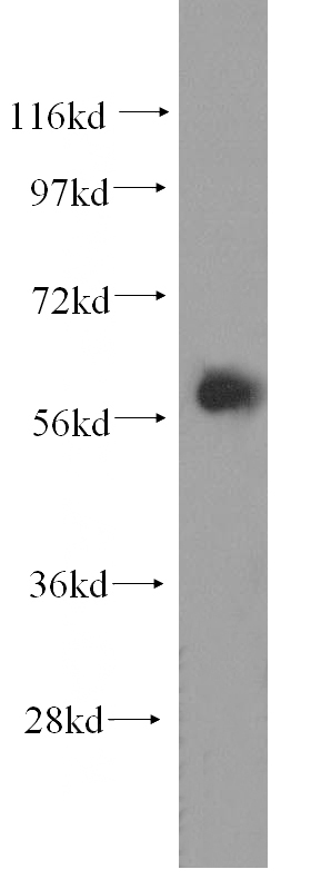 human skeletal muscle tissue were subjected to SDS PAGE followed by western blot with Catalog No:110184(EIF2B4 antibody) at dilution of 1:400