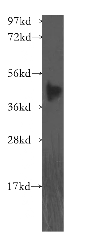 human placenta tissue were subjected to SDS PAGE followed by western blot with Catalog No:110559(FBXO8 antibody) at dilution of 1:500