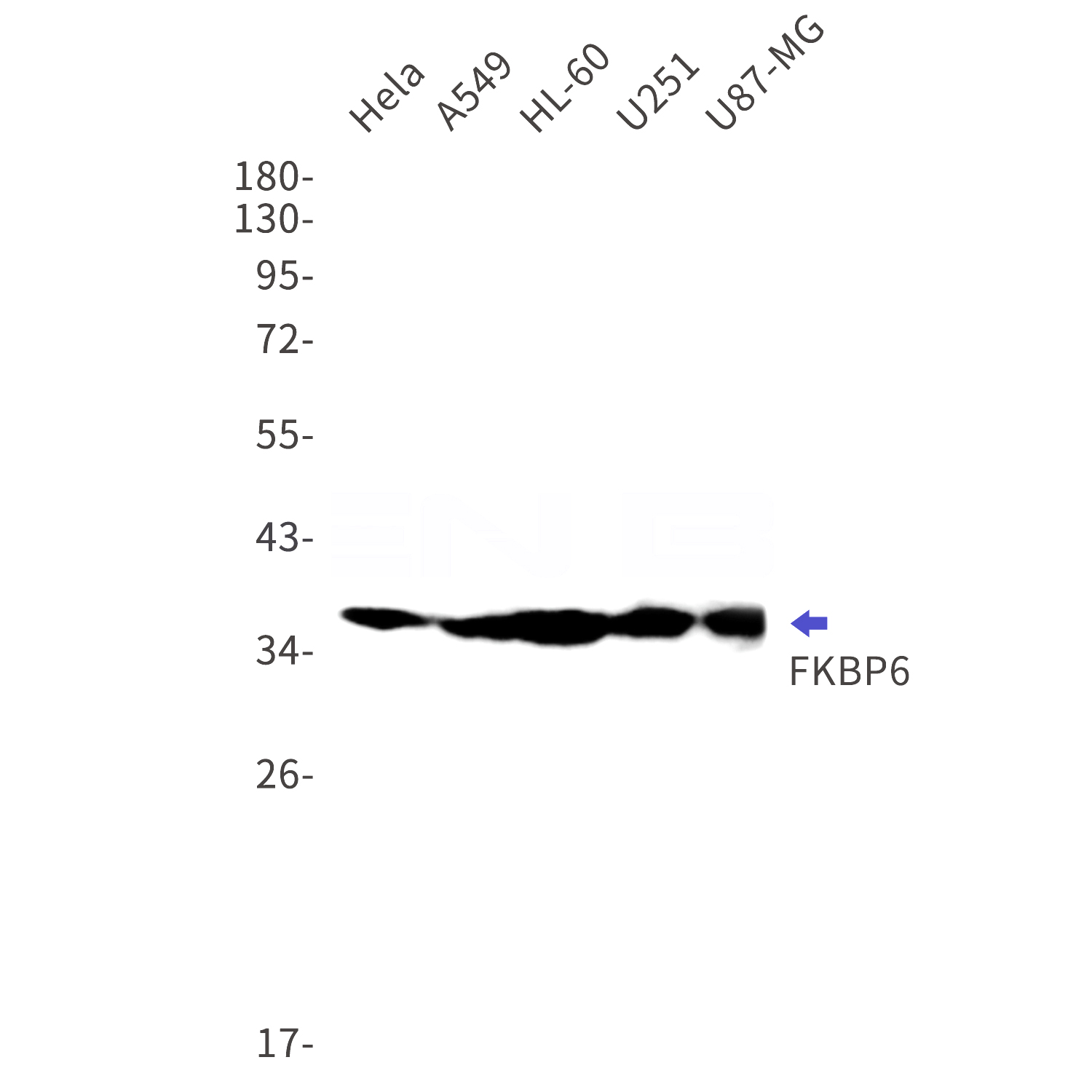 Western blot detection of FKBP6 in Hela,A549,HL-60,U251,U87-MG cell lysates using FKBP6 Rabbit mAb(1:1000 diluted).Predicted band size:37kDa.Observed band size:37kDa.