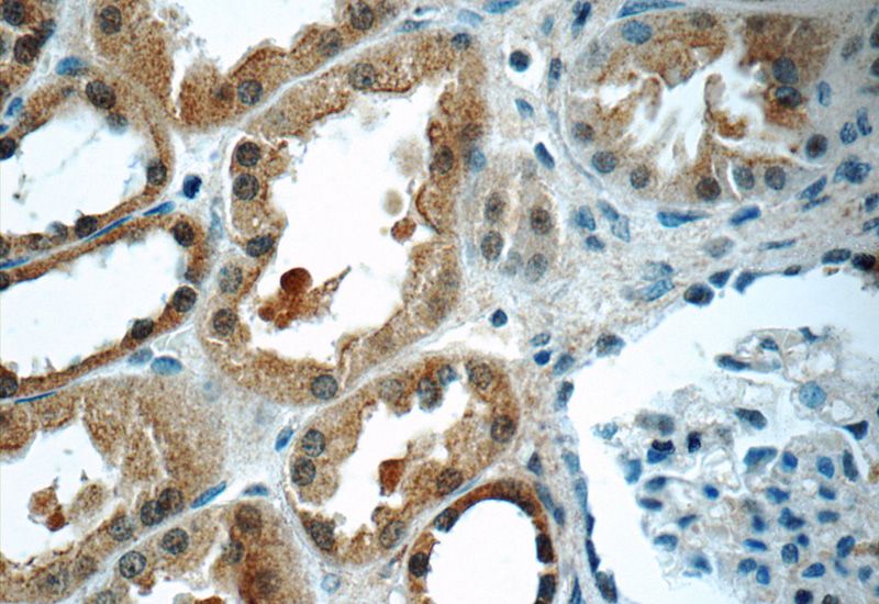 Immunohistochemistry of paraffin-embedded human kidney tissue slide using Catalog No:115021(SCRN3 Antibody) at dilution of 1:50 (under 40x lens)