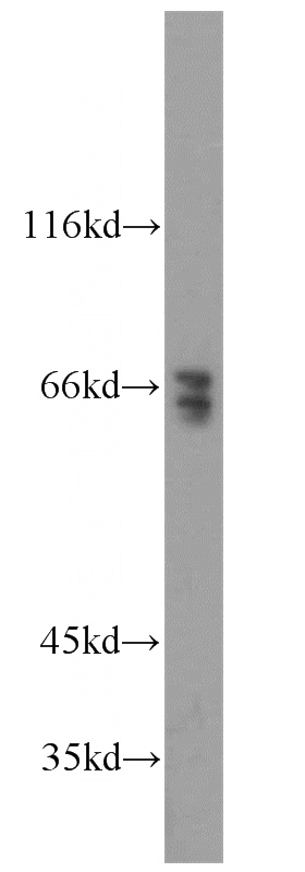 HEK-293 cells were subjected to SDS PAGE followed by western blot with Catalog No:116311(TRIM32 antibody) at dilution of 1:500