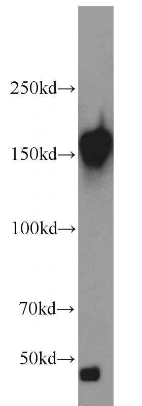 HeLa cells were subjected to SDS PAGE followed by western blot with Catalog No:109392(CLIP1 antibody) at dilution of 1:2000