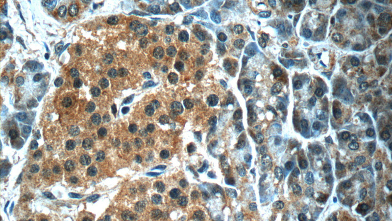 Immunohistochemistry of paraffin-embedded human pancreas slide using Catalog No:107965(ALDH1L2 Antibody) at dilution of 1:50