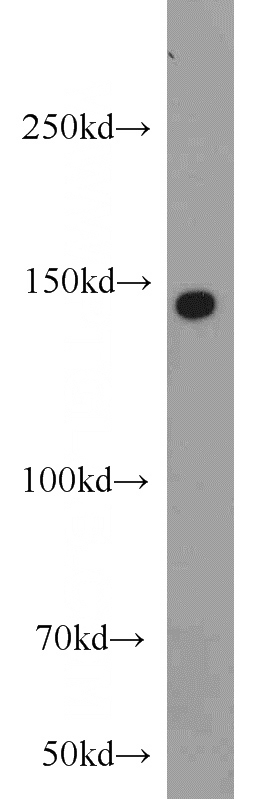 HeLa cells were subjected to SDS PAGE followed by western blot with Catalog No:115262(SH3PXD2A antibody) at dilution of 1:500