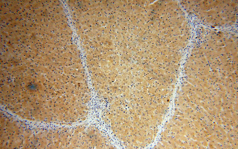 Immunohistochemical of paraffin-embedded human liver using Catalog No:111313(HGD antibody) at dilution of 1:100 (under 10x lens)