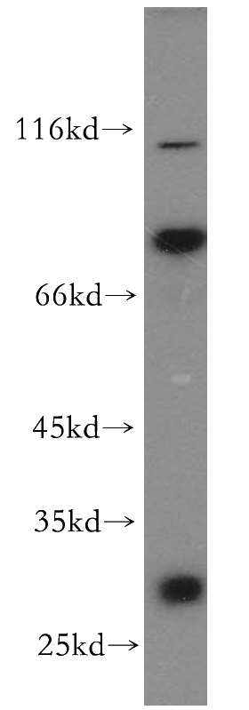 HeLa cells were subjected to SDS PAGE followed by western blot with Catalog No:111684(IGFBP2 antibody) at dilution of 1:300