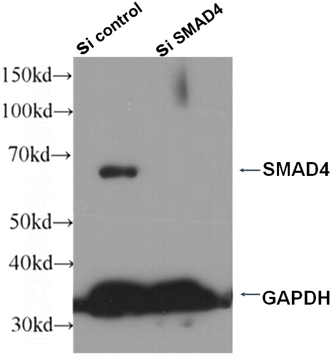 WB result of SMAD4 antibody (Catalog No:, 1:1000) with sh-coontrol and sh-SMAD4 transfected HepG2 cells