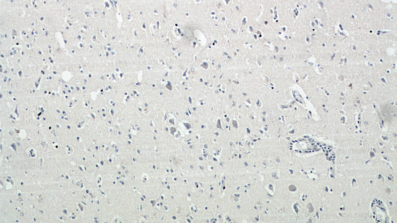 Immunohistochemical of paraffin-embedded human brain using Catalog No:112800(MRAP2 antibody) at dilution of 1:50 (under 10x lens)