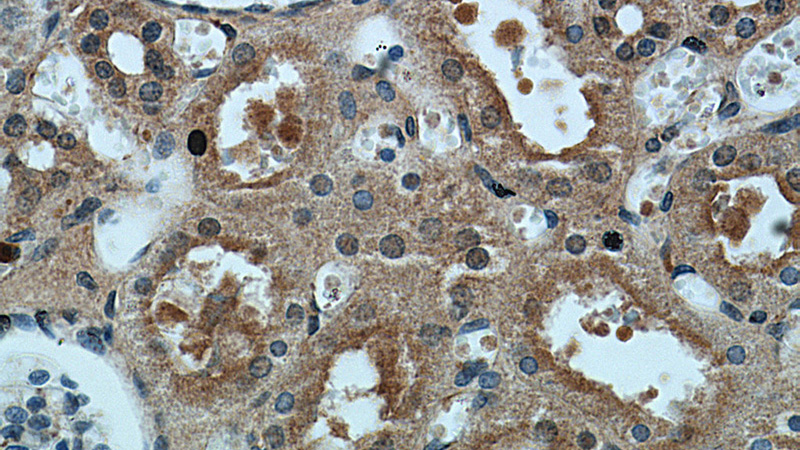 Immunohistochemical of paraffin-embedded human kidney using Catalog No:113540(P21 antibody) at dilution of 1:50 (under 40x lens)