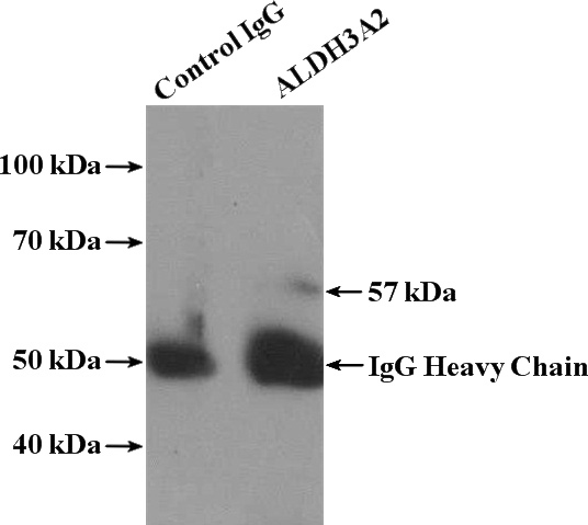 IP Result of anti-ALDH3A2 (IP:Catalog No:107968, 4ug; Detection:Catalog No:107968 1:1000) with HEK-293 cells lysate 3000ug.