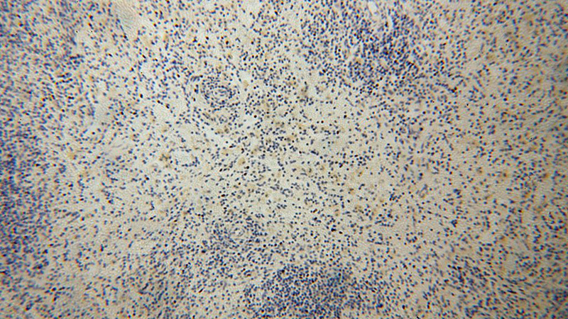 Immunohistochemical of paraffin-embedded human spleen using Catalog No:108177(ARHGAP4 antibody) at dilution of 1:100 (under 10x lens)