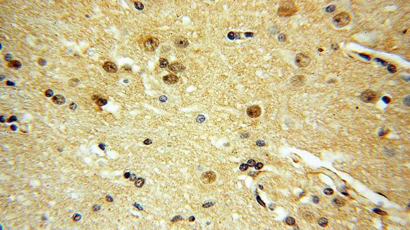 Immunohistochemical of paraffin-embedded human brain using Catalog No:116889(YPEL1 antibody) at dilution of 1:400 (under 40x lens)